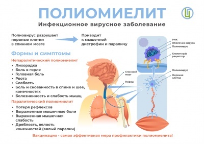 Информация по заболеванию вирусной этиологии - 